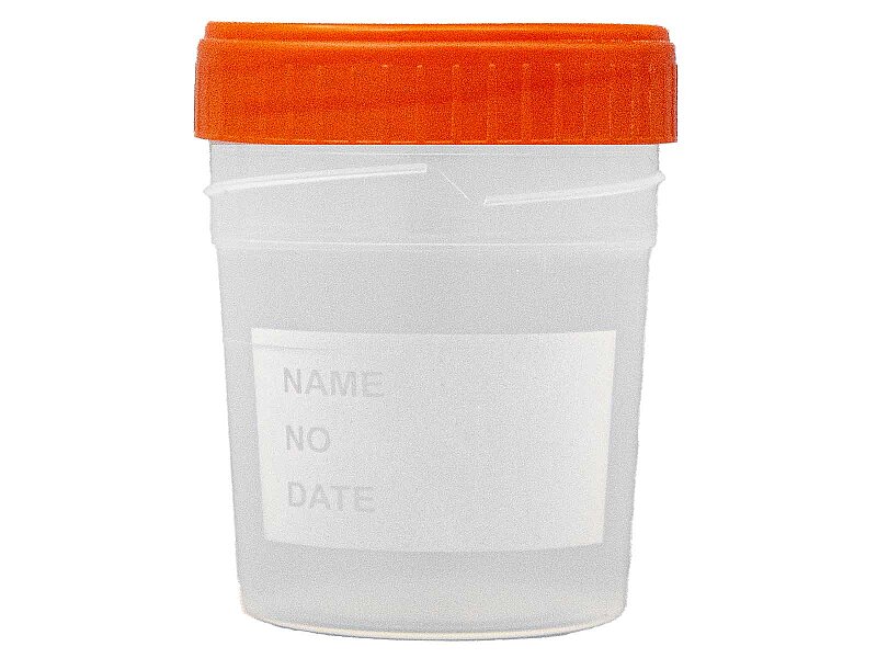 Numune Beheri Steril 100 ML